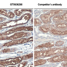 ACE2 antibody [HL1092] (GTX636265)